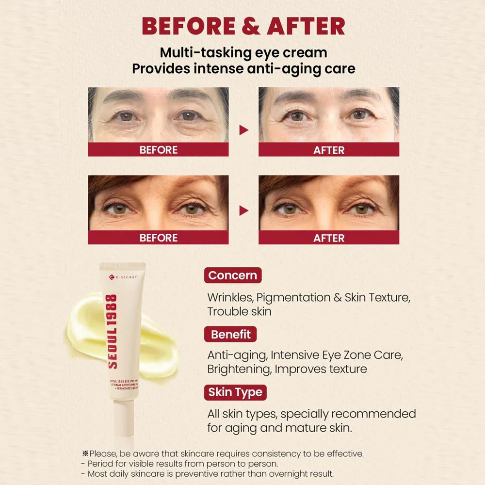 Seoul 1988 Eye Cream K‑SECRET – Retinal Liposome 4 % + Fermented Bean (30 ml)