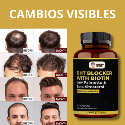 DHT Blocker with Biotin 5000 mcg – Saw Palmetto & Beta-Sitosterol (60 cápsulas)